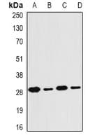Polyclonal Rabbit anti-Human PSMB4 Antibody (IF, WB)
