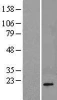 Human PPP3R1 / Calcineurin B Protein (Over-Expression Lysate Myc-DDK (Flag))
