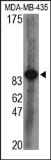 Polyclonal Rabbit anti-Human AGO2 / EIF2C2 Antibody (WB)