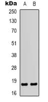 MLC2 / MYL9 Antibody (N-Terminus)