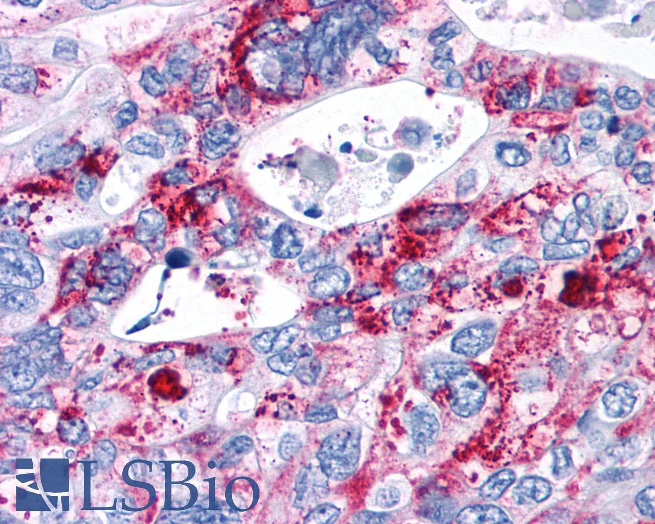 IHC-plus™ CNR2 / CB2 Antibody (Cytoplasmic Domain)