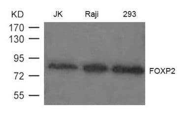 Polyclonal Rabbit anti-Human FOXP2 Antibody (WB)