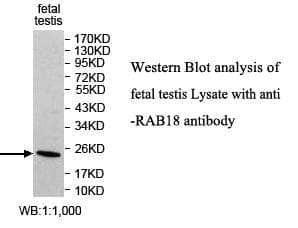 IHC-plus™ RAB18 Antibody (aa1-206)