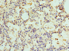 Polyclonal Rabbit anti-Human ADSL / Adenylosuccinate Lyase Antibody (aa1-310, IHC, WB)