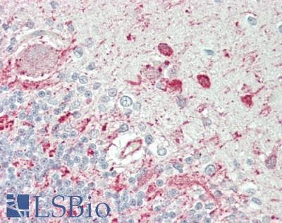 IHC-plus™ SNCG / Gamma-Synuclein Antibody