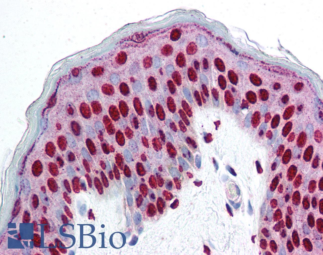 IHC-plus™ SMAD3 Antibody (phospho-Ser423/425)