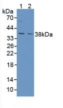 AGA / Aspartylglucosaminidase Antibody (aa24-260)