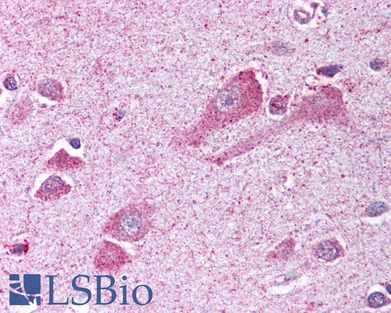 IHC-plus™ TRPM7 Antibody (C-Terminus)