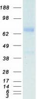 Human TF / Transferrin Protein (Recombinant Myc-DDK (Flag))