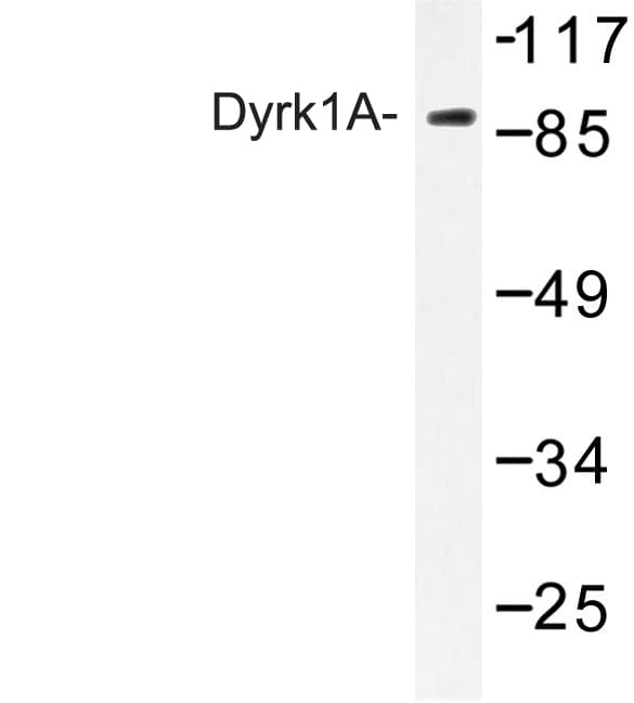 Polyclonal Rabbit anti-Human DYRK / DYRK1A Antibody (Gln39, IHC, IF, WB)
