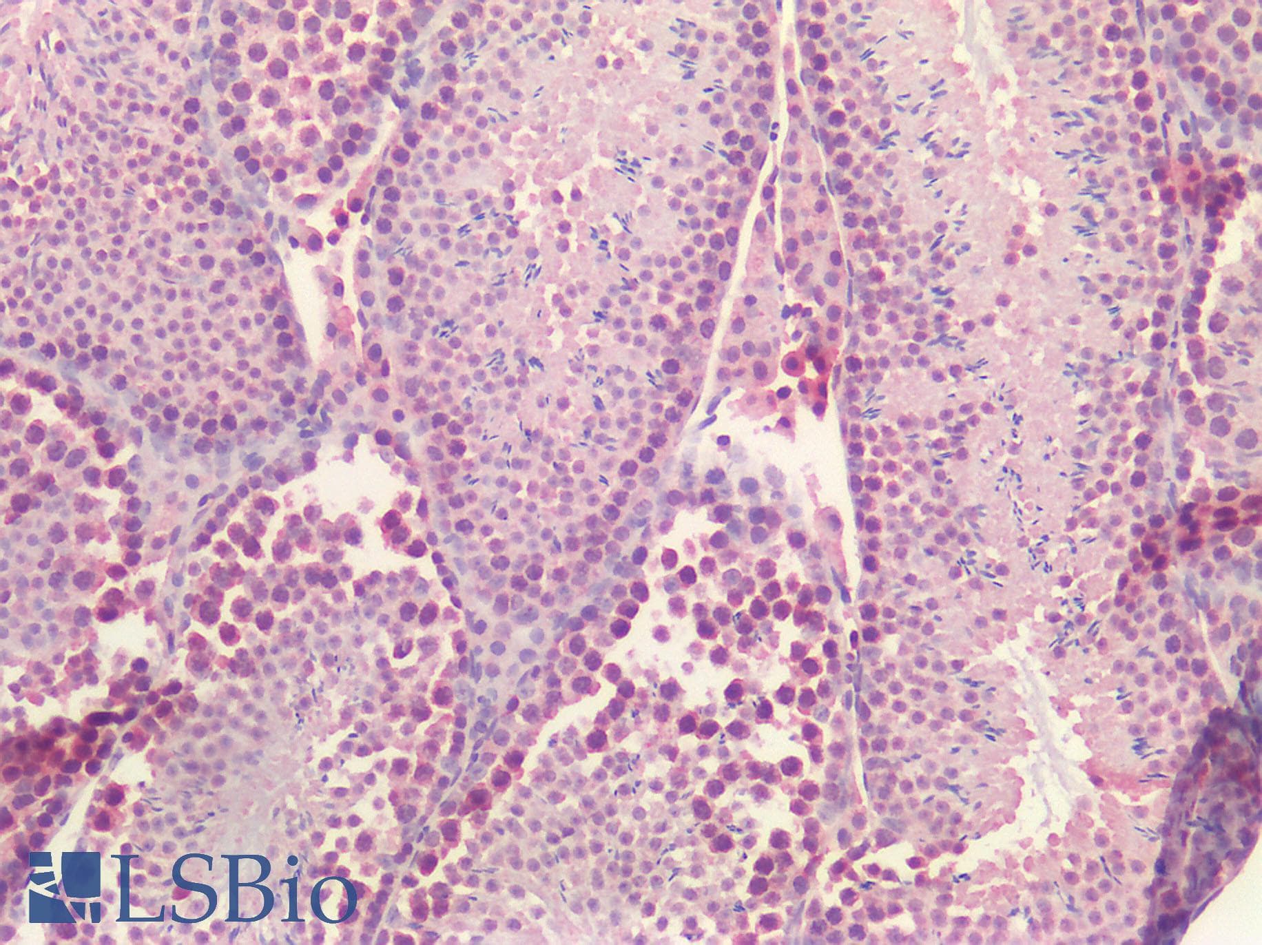 PathPlus™ IL-10 Antibody (clone JES5-2A5)