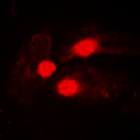 BTK Antibody (phospho-Tyr551)