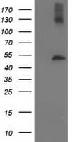 TUBB4 / Tubulin Beta 4 Antibody (clone OTI6E3)