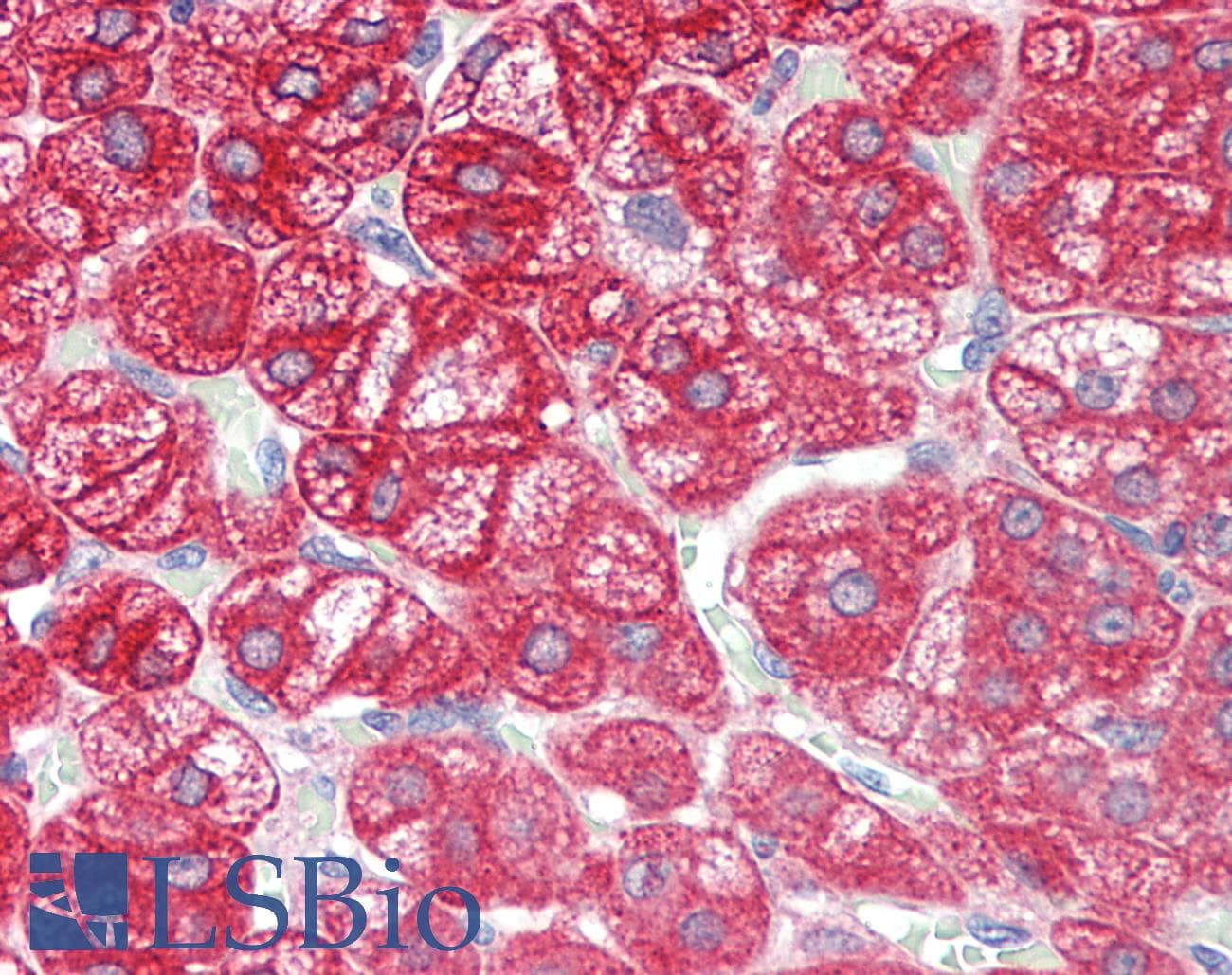 IHC-plus™ Polyclonal Rabbit anti-Human ADGRF5 / GPR116 Antibody (aa11-60, IHC, IF, WB)