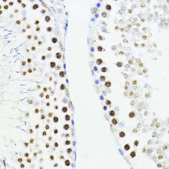 ZEB1 / AREB6 Antibody