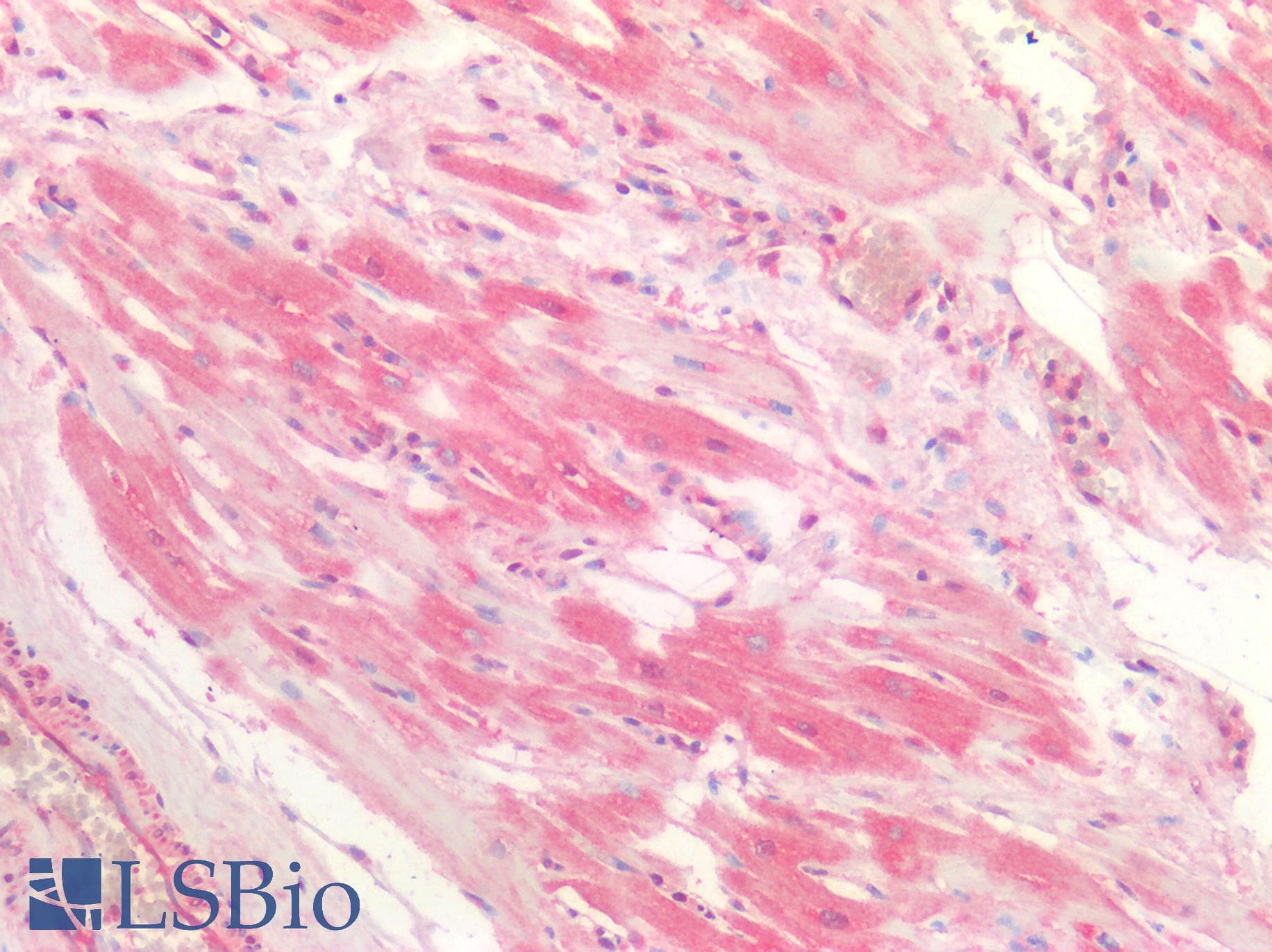 IHC-plus™ Polyclonal Rabbit anti-Human CTSK / Cathepsin K Antibody (IHC)