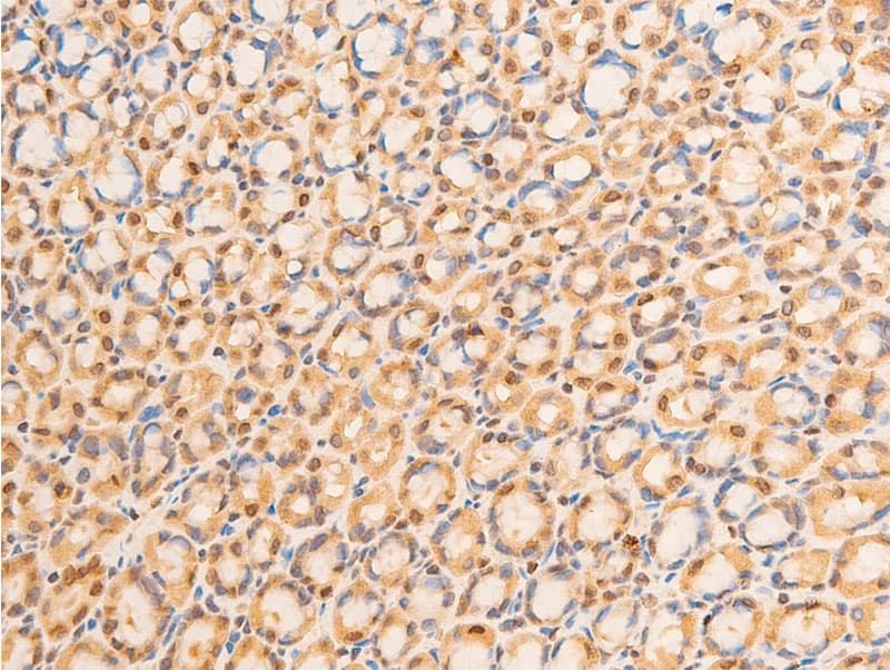LMNA / Lamin A+C Antibody (phospho-Ser392)