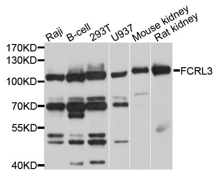Polyclonal Rabbit anti-Human FCRL3 Antibody (WB)