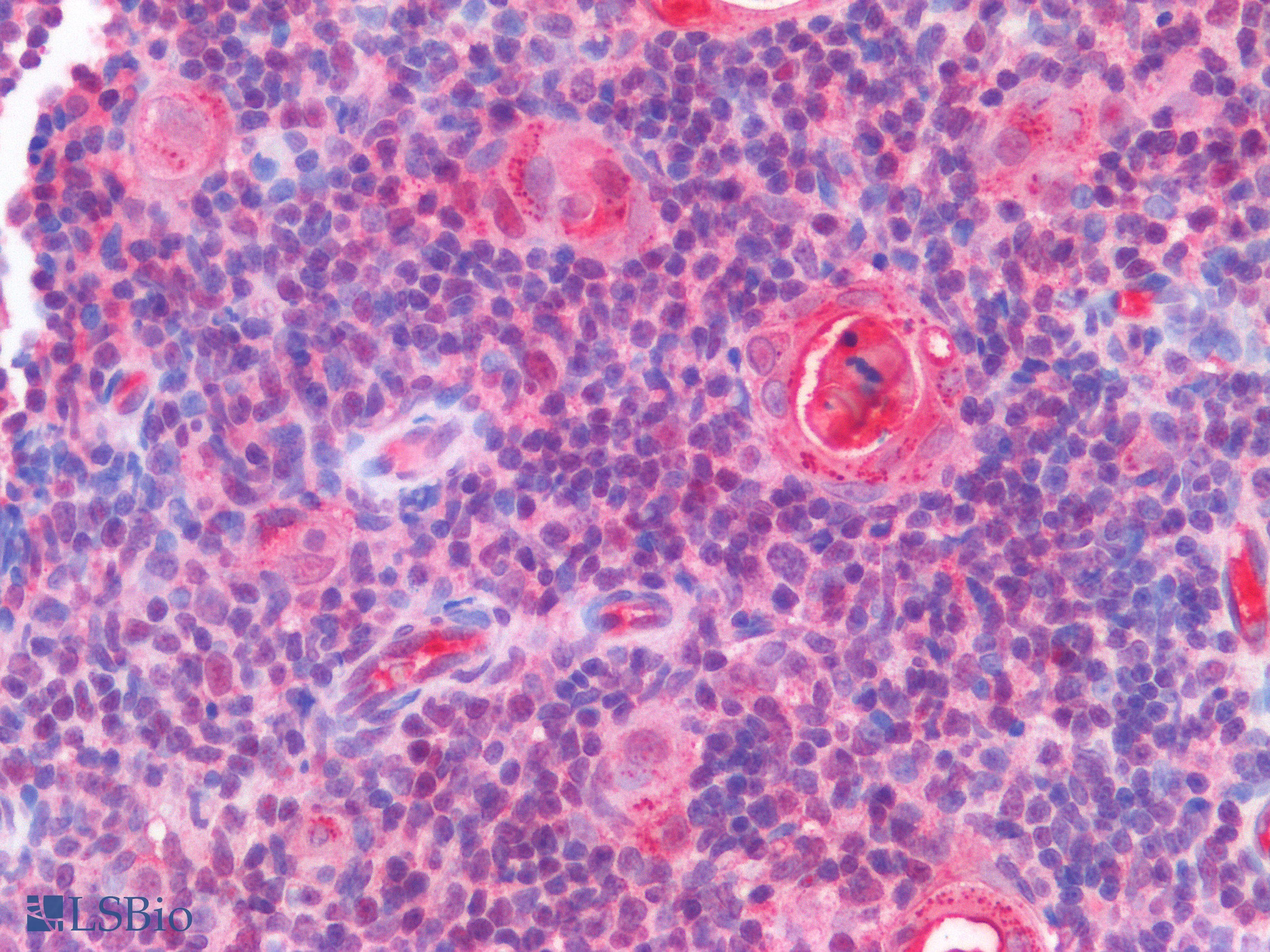 PathPlus™ MYC / c-Myc Antibody (aa400-450, clone 9E10)