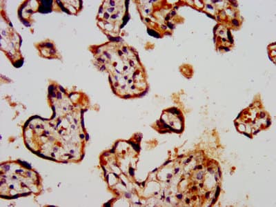 KCNK3 / OAT1 Antibody