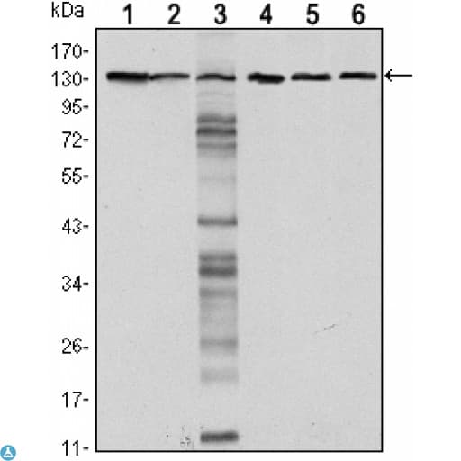 CDH1 / E Cadherin Antibody