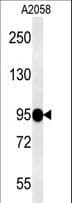 Polyclonal Rabbit anti-Human SEMA6A / Semaphorin 6A Antibody (aa29-57, WB)