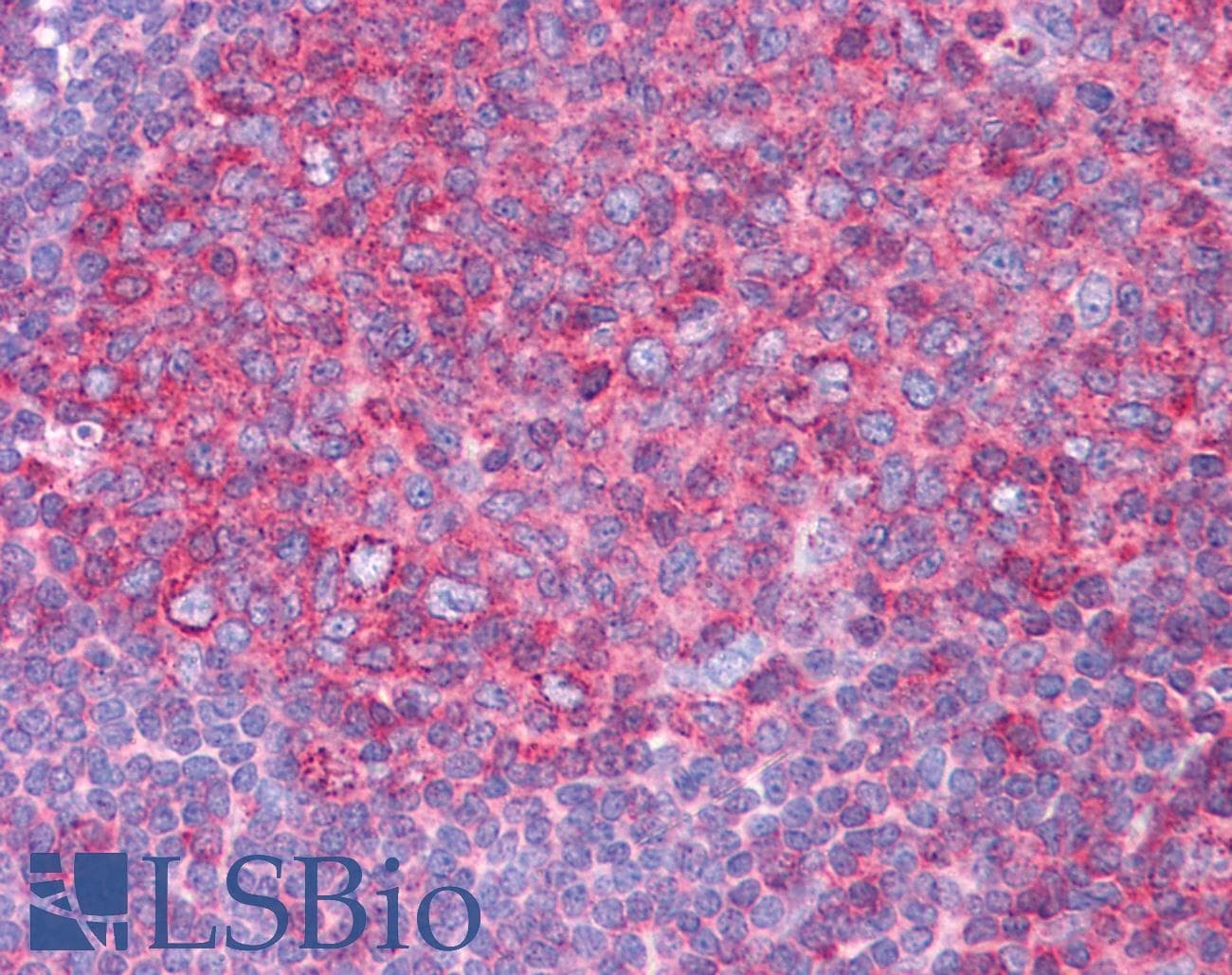 HSPA8 / HSC70 Antibody (aa143-192)
