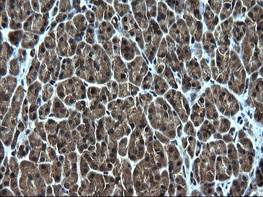 ZFAND3 / TEX27 Antibody (clone OTI1C5)