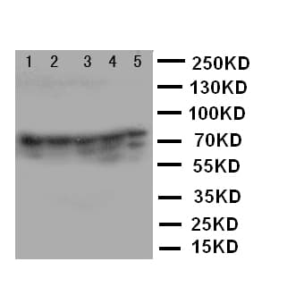Polyclonal Rabbit anti-Human XRCC5 / Ku80 Antibody (aa648-662, IHC, WB)
