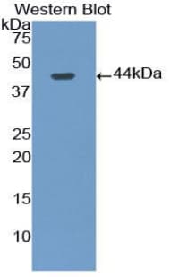 Gastrin Antibody