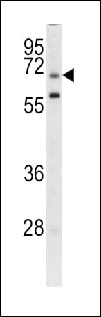 Polyclonal Rabbit anti-Human LRRC32 Antibody (aa234-260, IHC, WB)