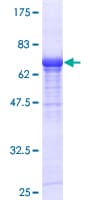 Human VIL1 / Villin Protein (Recombinant GST)