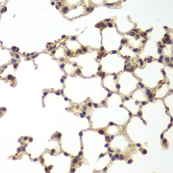IHC-plus™ GSS / Glutathione Synthetase Antibody