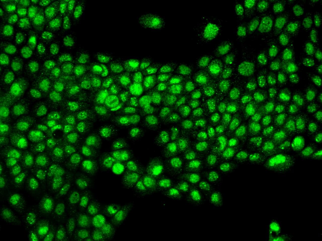NPAS2 Antibody