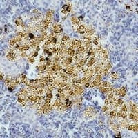 CASP8 / Caspase 8 Antibody