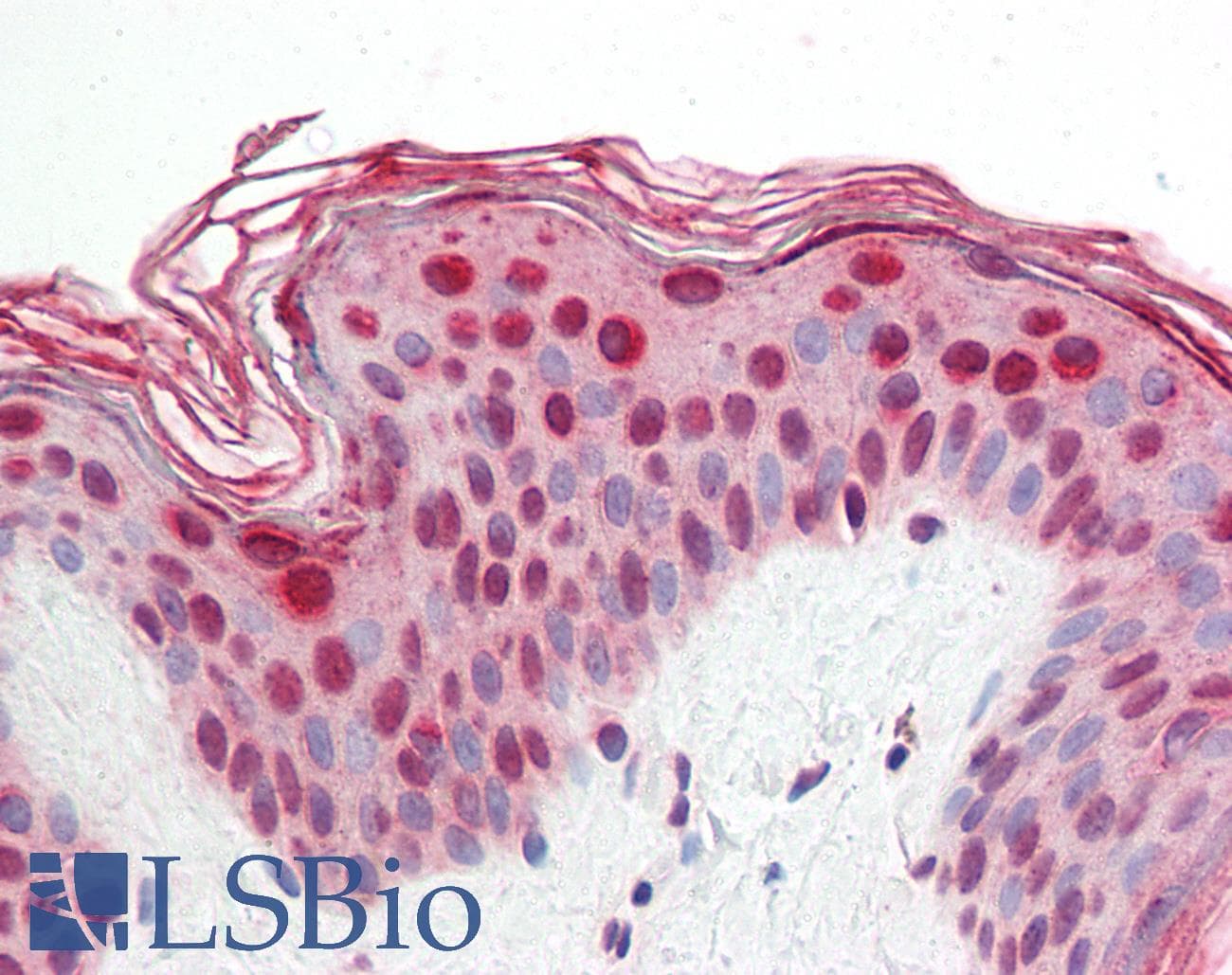 IHC-plus™ CRTR1 / TFCP2L1 Antibody