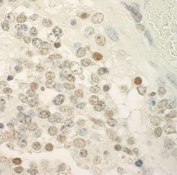 PRCC / RCCP1 Antibody (aa125-175)