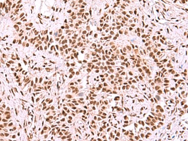 Polyclonal Rabbit anti-Human SF3B130 / SF3B3 Antibody (IHC)