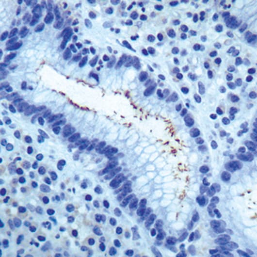 Helicobacter pylori Antibody