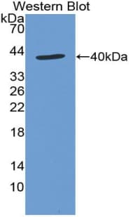 SDF1 / CXCL12 Antibody (aa21-89)