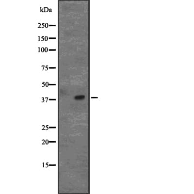 AIM / CD5L Antibody