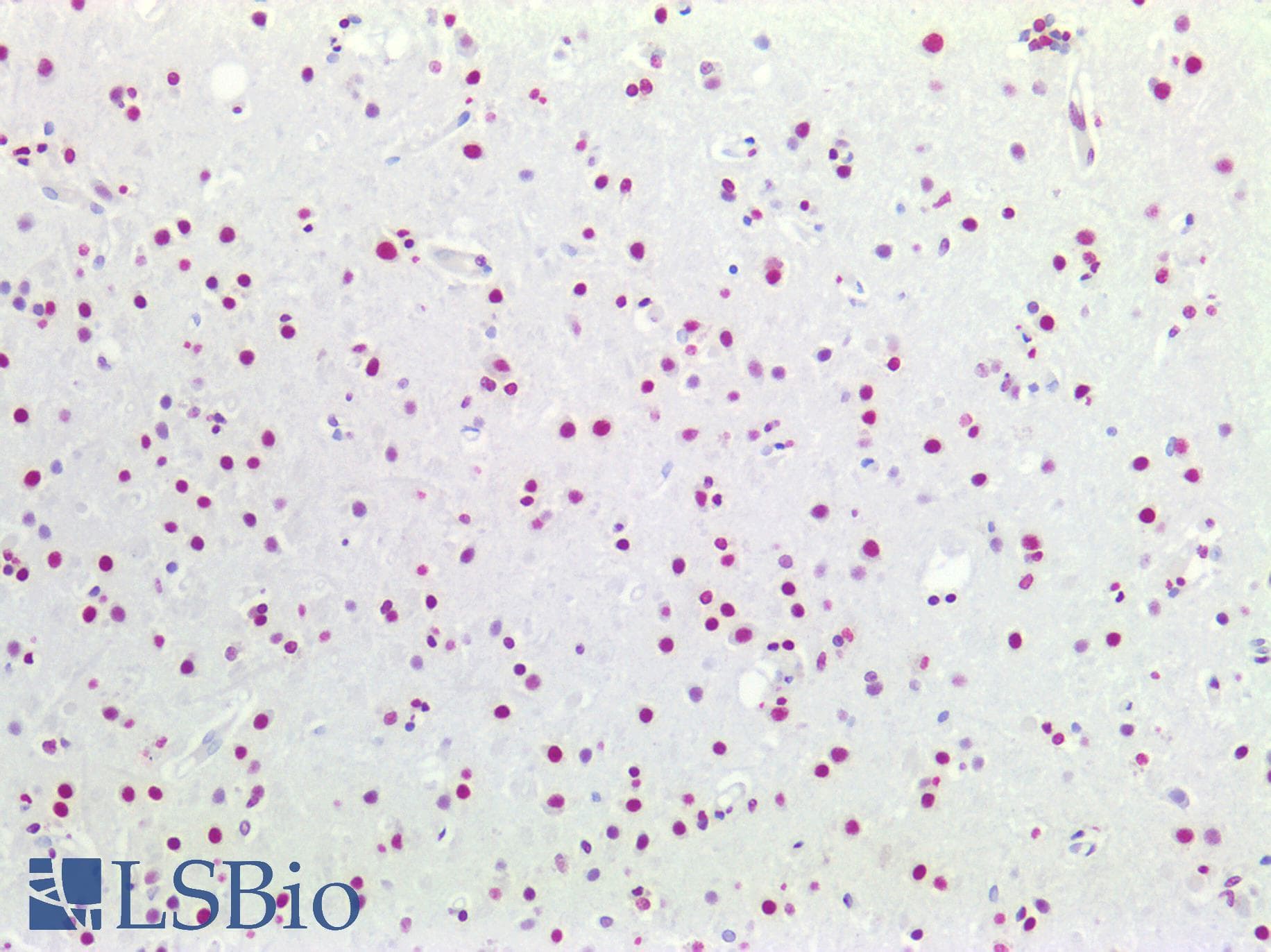PathPlus™ HES5 Antibody