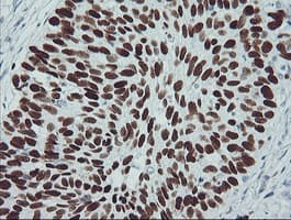 TP53 / p53 Antibody (clone OTI3A6)