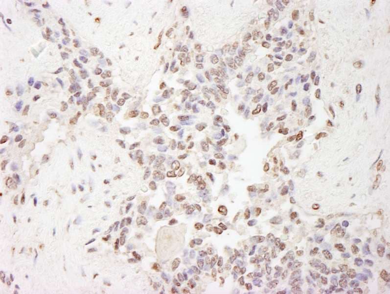 IHC-plus™ MBD2 Antibody (aa361-411)