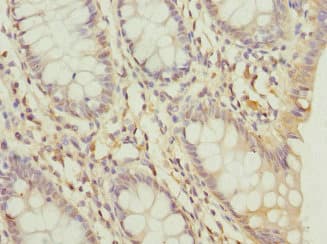 DDX20 / GEMIN3 Antibody