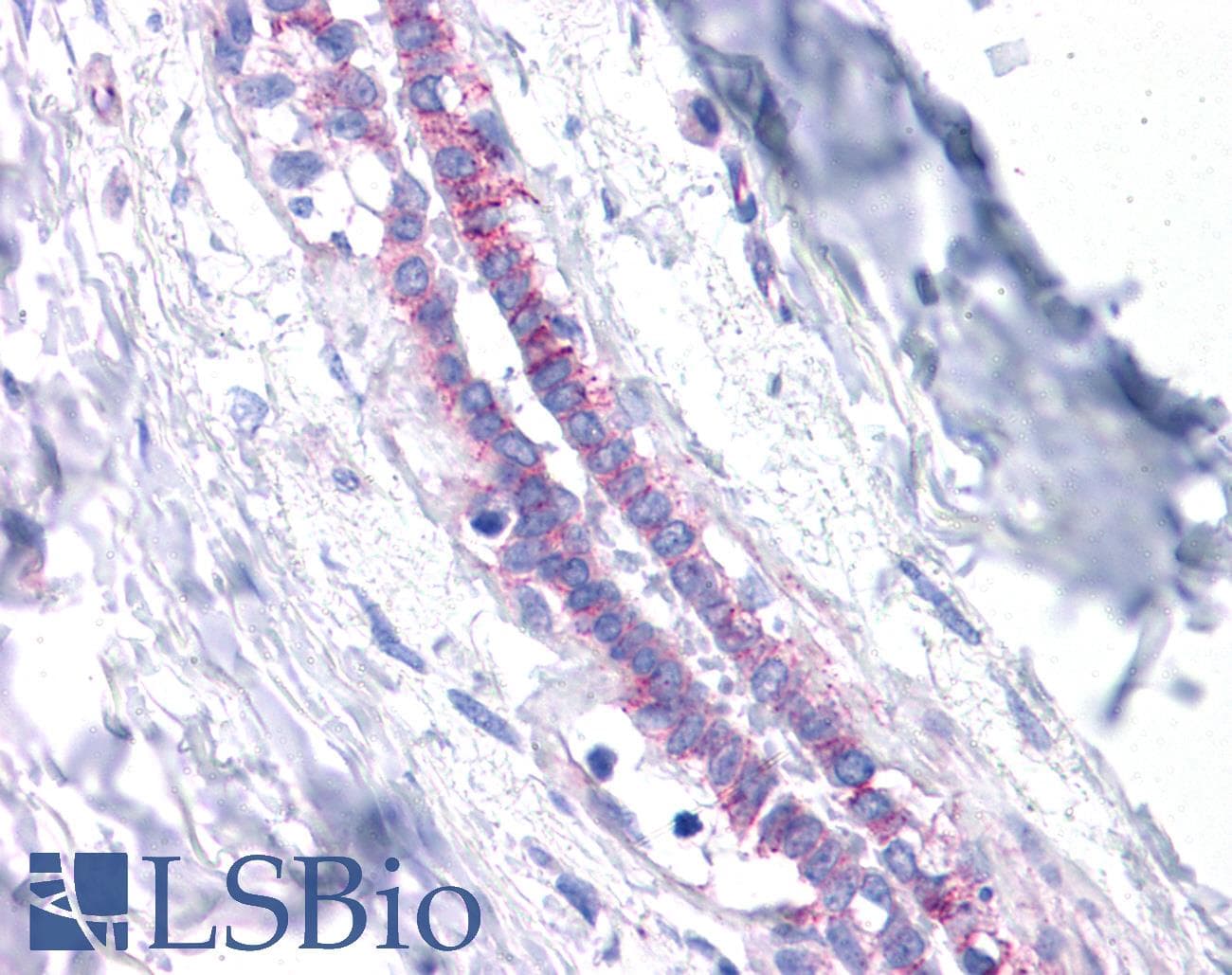 PathPlus™ Polyclonal Rabbit anti-Human CDH1 / E Cadherin Antibody (aa503-552, IHC, WB)