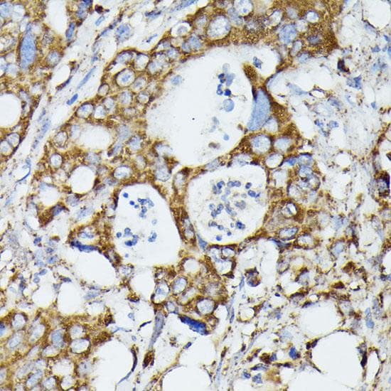 MTIF2 Antibody