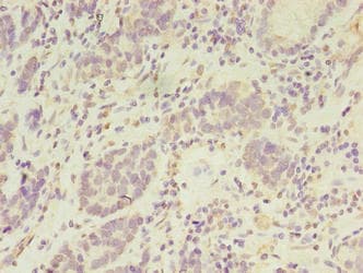 PSKH2 Antibody