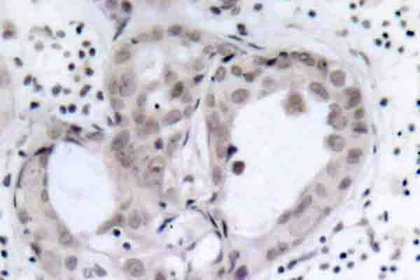 PTEN Antibody (phospho-Ser380)