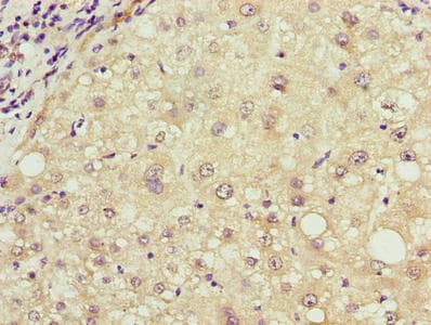Polyclonal Rabbit anti-Human TCL / RHOJ Antibody (IHC)